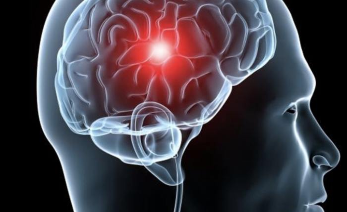 老人中風會好嗎