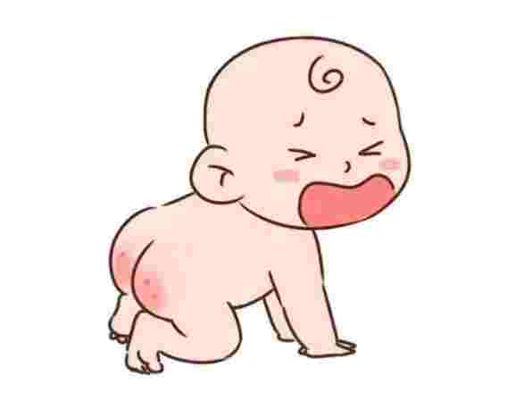 紅屁屁多久會好