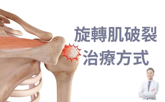 旋轉肌破裂手術費用