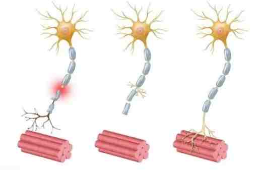 神經受損會好嗎