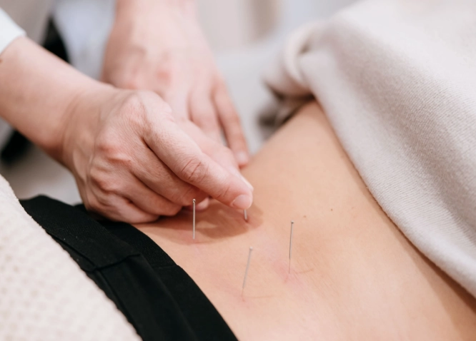 針灸後禁忌全攻略：中醫師親授避免副作用的關鍵守則