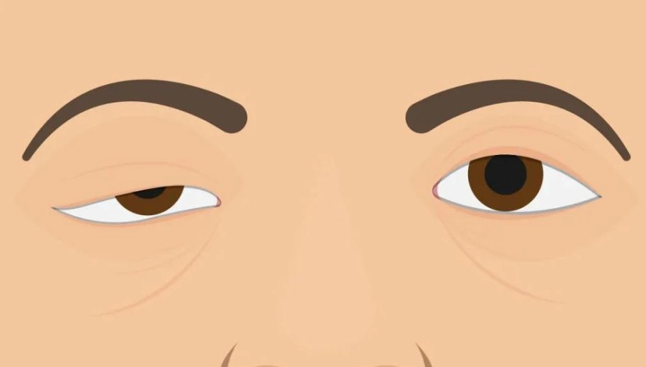 肌無力要治療多久