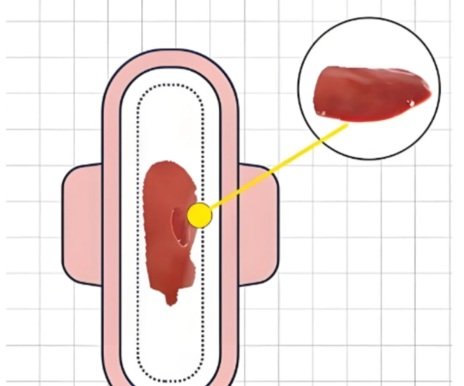 月經血塊很大塊怎麼辦