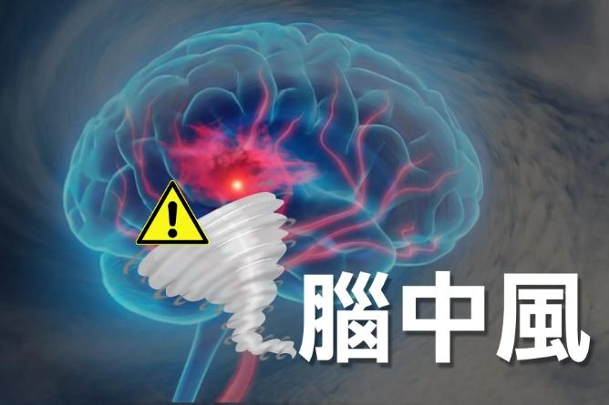 中風康復的秘訣