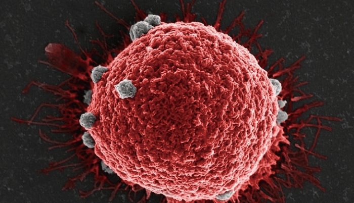 惡性腫瘤會好嗎