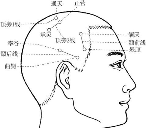 頭頂穴位按摩全攻略：位置、功效與常見問題深度解析